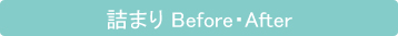 詰まり Before・After